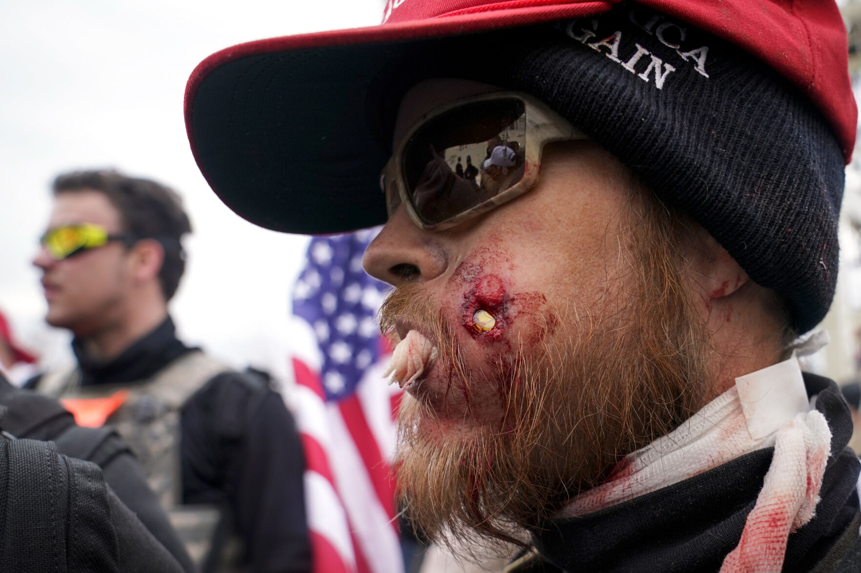A rioter is shown injured